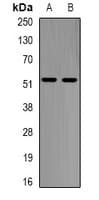 GLA / Alpha Galactosidase Antibody