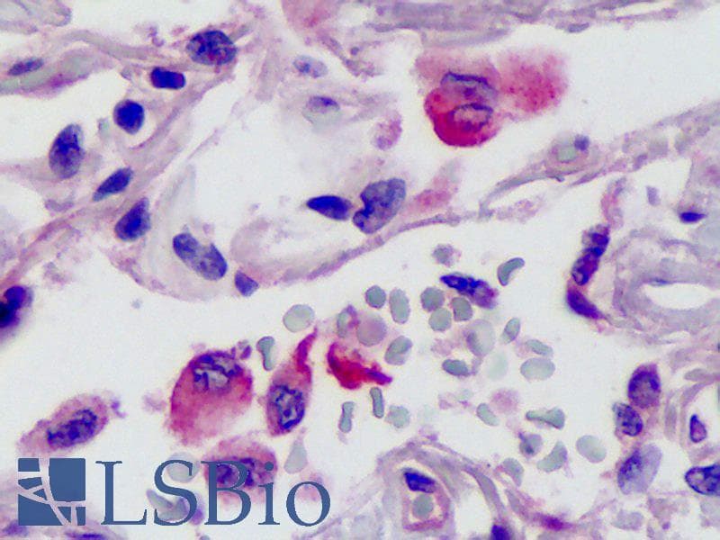 IHC-plus™ Polyclonal Rabbit anti-Human Neurotrypsin Antibody (IHC, IF, WB)