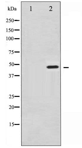 SYT1 / Synaptotagmin Antibody (phospho-Ser309)