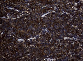 NME1 / NM23 Antibody (clone OTI6E8)