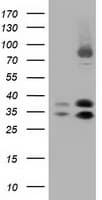 QPRT Antibody (clone OTI2H4)