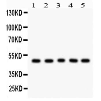 CCNA2 / Cyclin A2 Antibody (aa10-168)