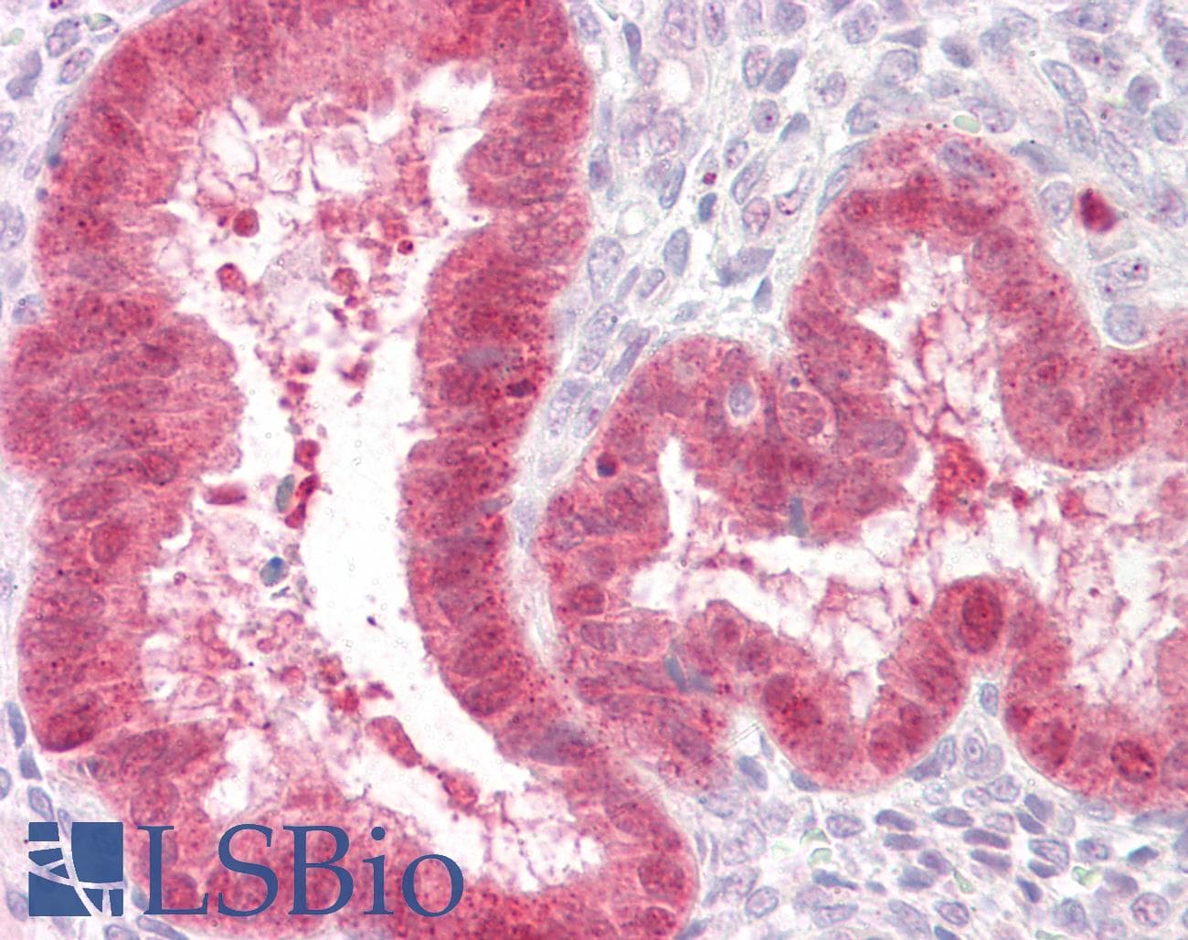 PathPlus™ TGFB3 / TGF Beta3 Antibody (aa261-310)
