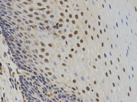 SUMO2 Antibody