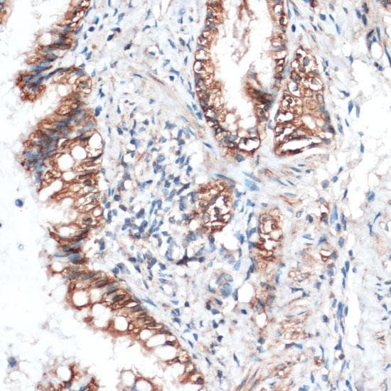 AQP4 / Aquaporin 4 Antibody