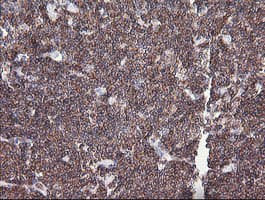 Monoclonal Mouse anti-Human DEF6 Antibody (clone OTI1E3, IHC, IF, WB)