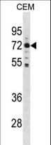 Polyclonal Rabbit anti-Human MAK Antibody (aa595-623, WB)
