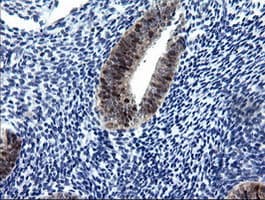 CMPK / CMPK1 Antibody (clone OTI1A1)