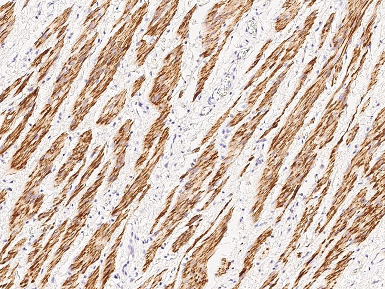 Monoclonal Mouse anti-Human DES / Desmin Antibody (clone 18, Preservative Free, IHC)