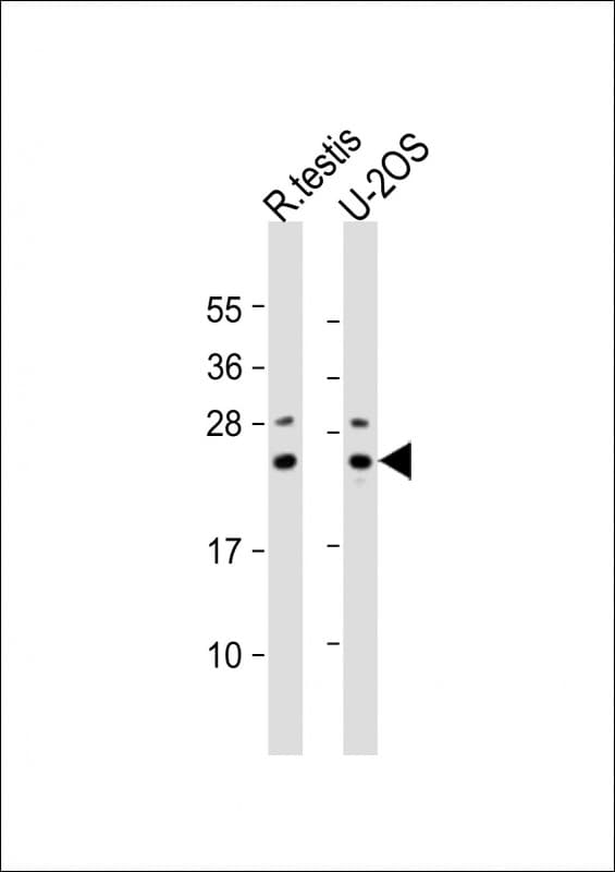 Polyclonal Rabbit anti-Human PSMB9 Antibody (aa189-219, WB)