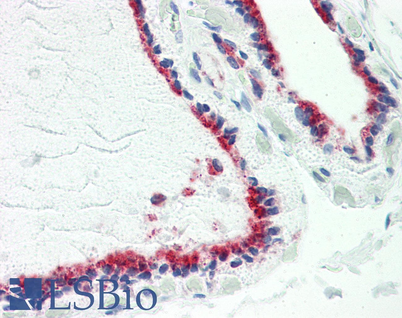 IHC-plus™ TUSC2 / FUS1 Antibody (aa41-90)