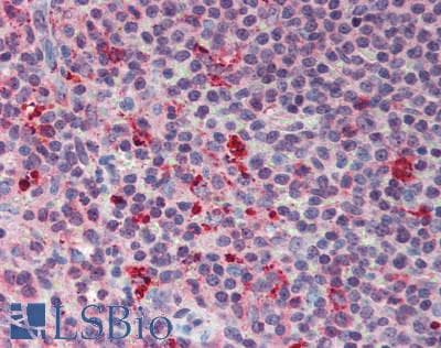 Polyclonal Rabbit anti-Human GRN / Granulin Antibody (aa234-419, IHC, WB)