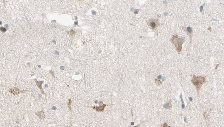 KPI-2 / LMTK2 Antibody