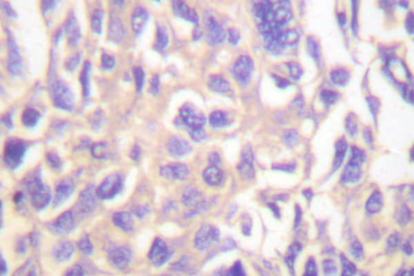 TK1 / TK / Thymidine Kinase Antibody (Pro7)