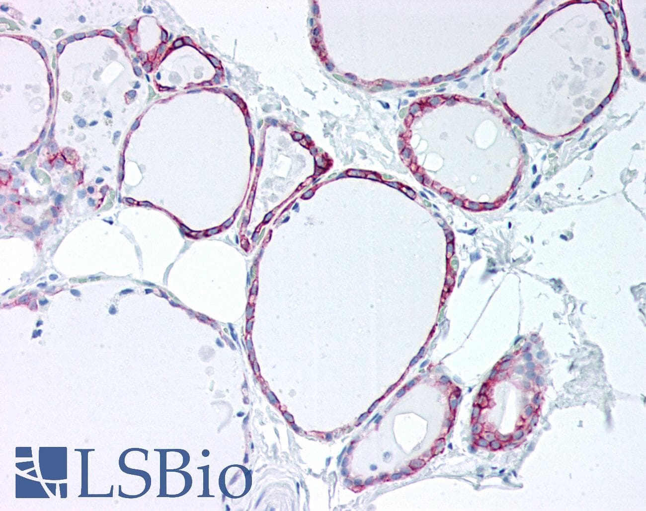 IHC-plus™ Monoclonal Mouse anti-Human KRT7 / CK7 / Cytokeratin 7 Antibody (clone ABT-CK7, IHC, WB)