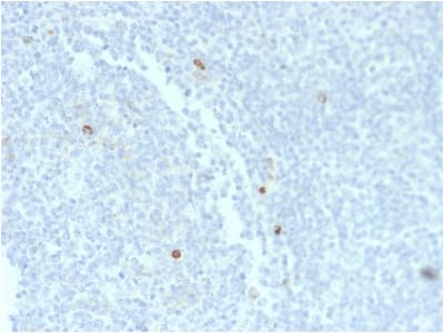 IGHM / IgM Antibody (clone rIM373)