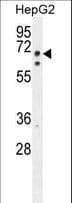 TMEM153 / LMF2 Antibody (aa535-564)