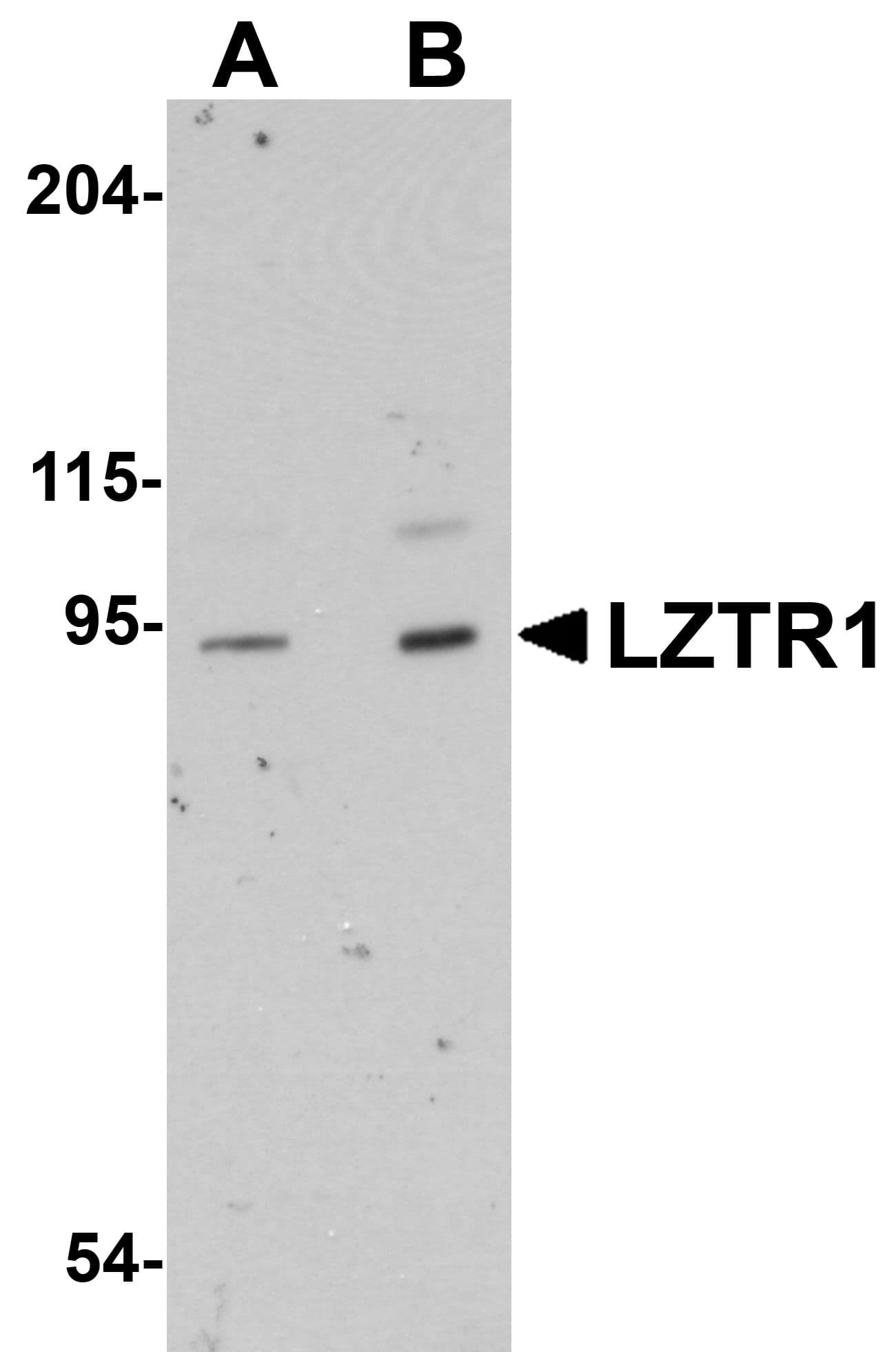 Polyclonal Rabbit anti-Human LZTR1 Antibody (IHC, WB)