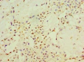 STARD3 / MLN64 Antibody (aa170-445)