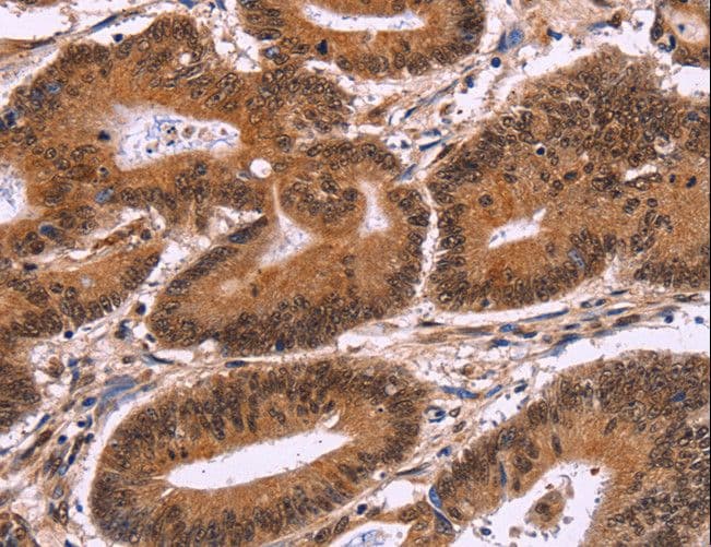 CARMA1 / CARD11 Antibody