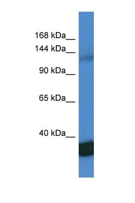 Polyclonal Rabbit anti-Human PPP1R12A / MYPT1 Antibody (aa860-909, WB)