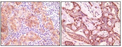 SNCG / Gamma-Synuclein Antibody (clone 1H10D2)
