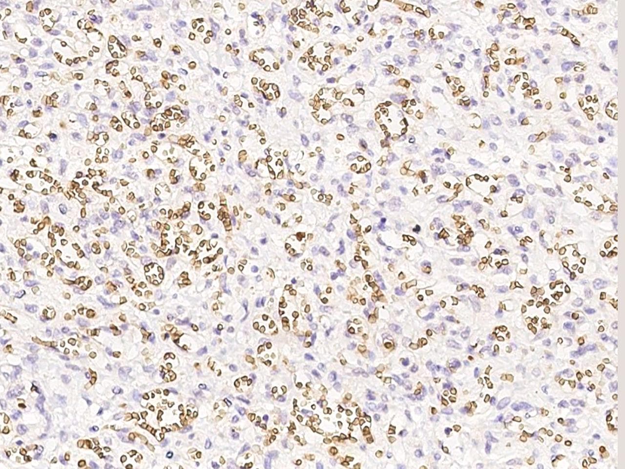 Band 4.1 / EPB41 Antibody