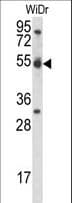 Polyclonal Rabbit anti-Human CCNI / Cyclin I Antibody (aa302-331, WB)