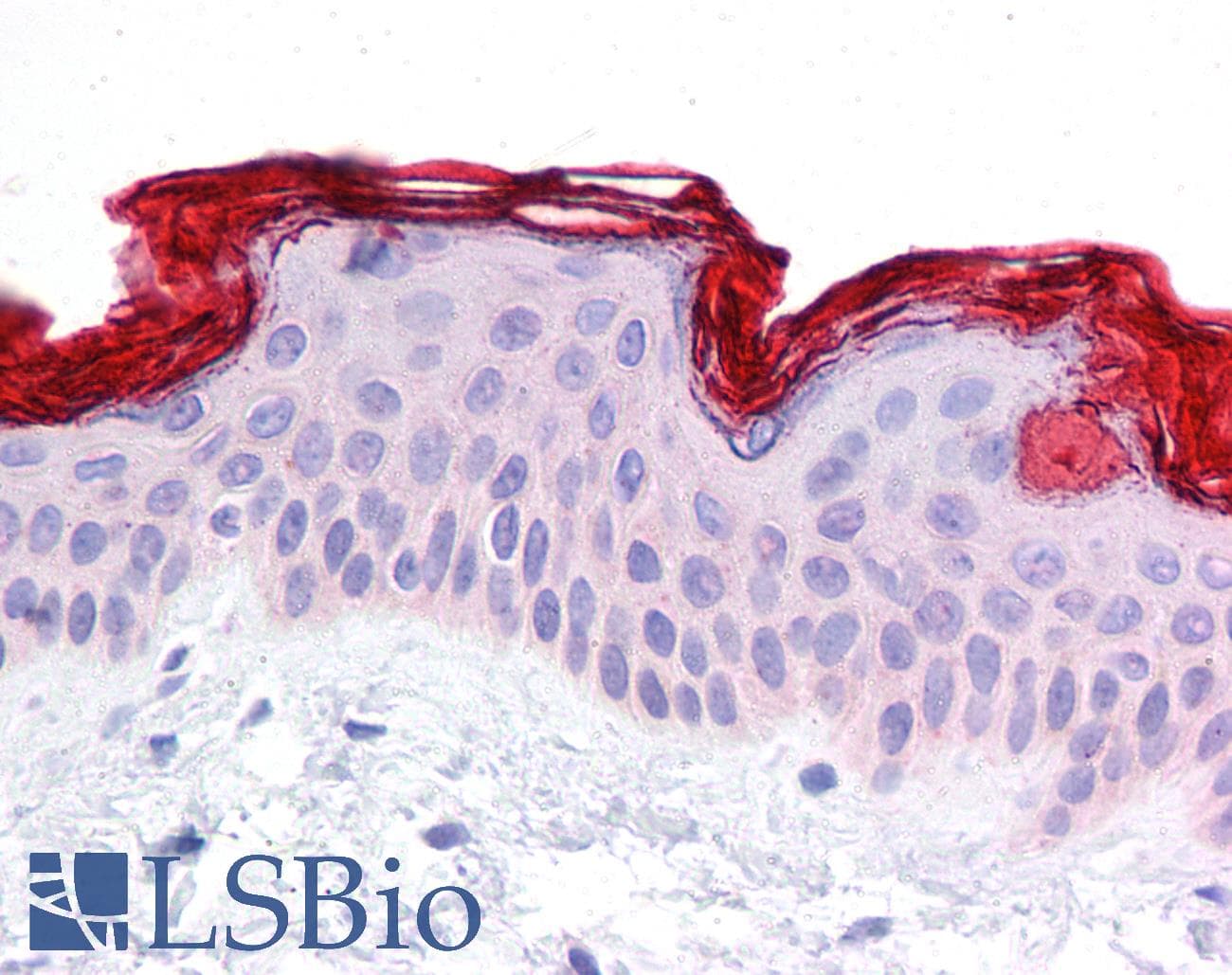 Polyclonal Rabbit anti-Human DBT / E2 Antibody (aa35-84, IHC, WB)