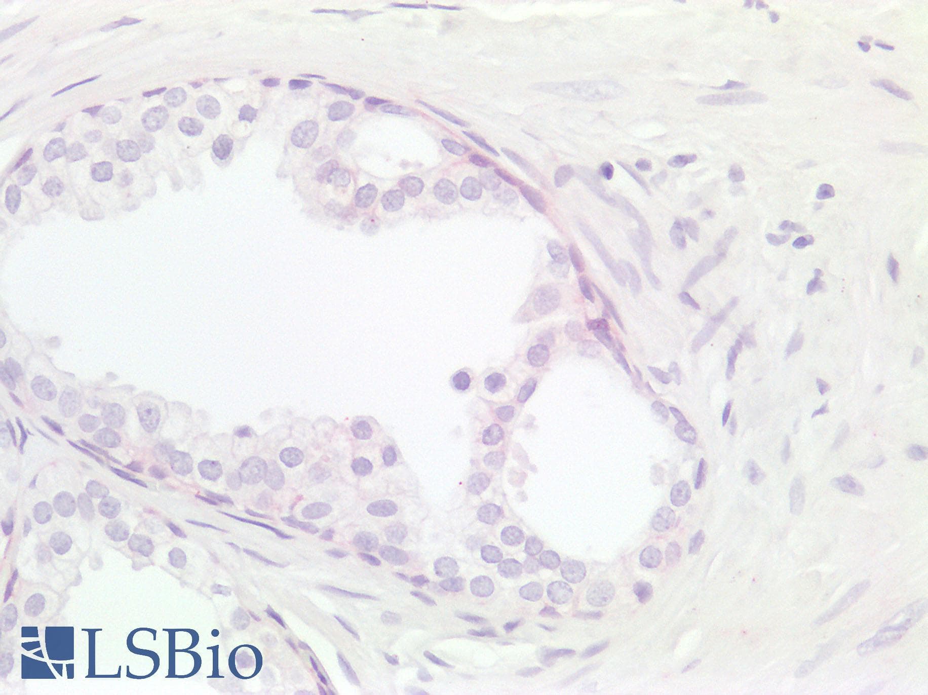 PathPlus™ Monoclonal Mouse anti-Human IL17A Antibody (clone 4K5F6, aa1-75, IHC, WB)