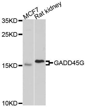 Polyclonal Rabbit anti-Human CR6 / GADD45G Antibody (WB)