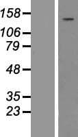 Human PLCG1 Protein (Over-Expression Lysate Myc-DDK (Flag))