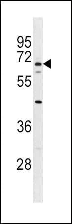 Polyclonal Rabbit anti-Human ALB / Serum Albumin Antibody (aa540-569, IHC, WB)