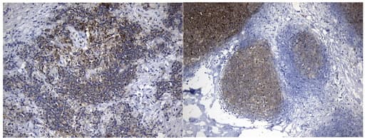 MME / CD10 Antibody (aa411-750, clone UMAB236)