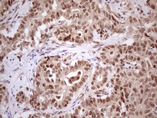 PRPK / TP53RK Antibody (clone OTI5A5)