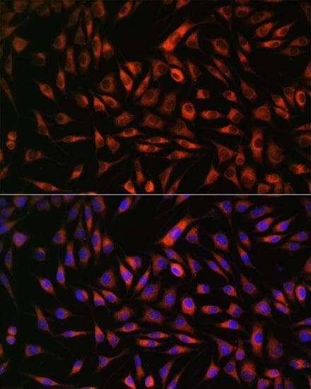 EML4 Antibody
