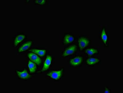 RGS2 Antibody (aa1-211)