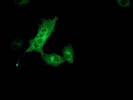 MGLL / Monoacylglycerol Lipase Antibody (clone OTI2G8)