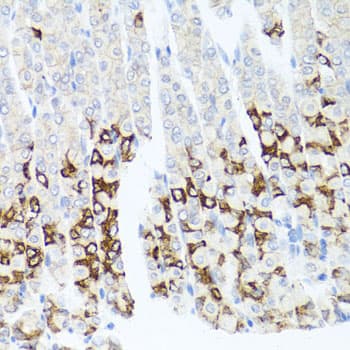 GPM6A / Glycoprotein M6A Antibody