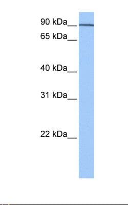 Polyclonal Rabbit anti-Human AP1G1 / Adaptin Gamma 1 Antibody (aa574-623, IHC, WB)