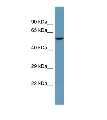 Polyclonal Rabbit anti-Human ANO9 / TMEM16J Antibody (aa180-229, WB)