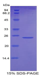 Mouse OSTF1 / OSF Protein (Recombinant His)