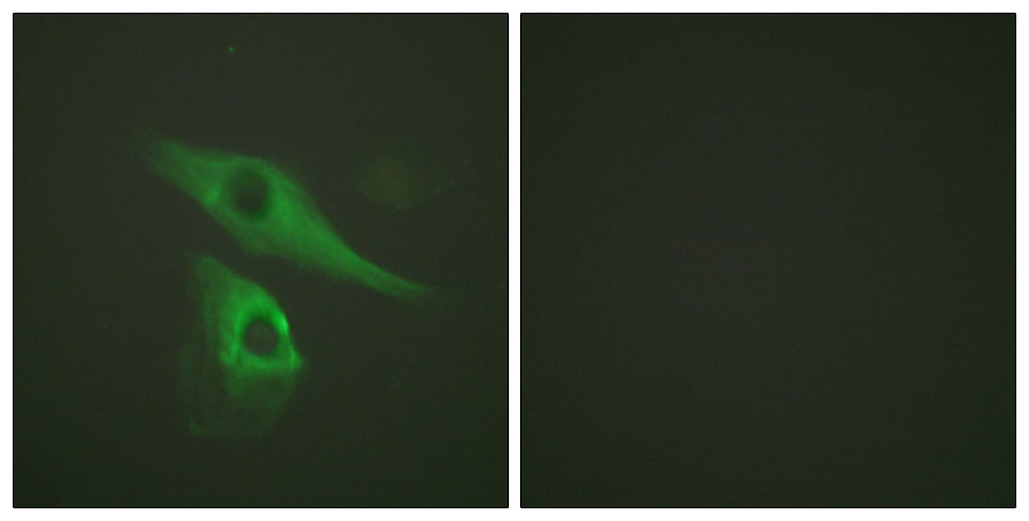 IHC-plus™ KRT8 / CK8 / Cytokeratin 8 Antibody (aa41-90)