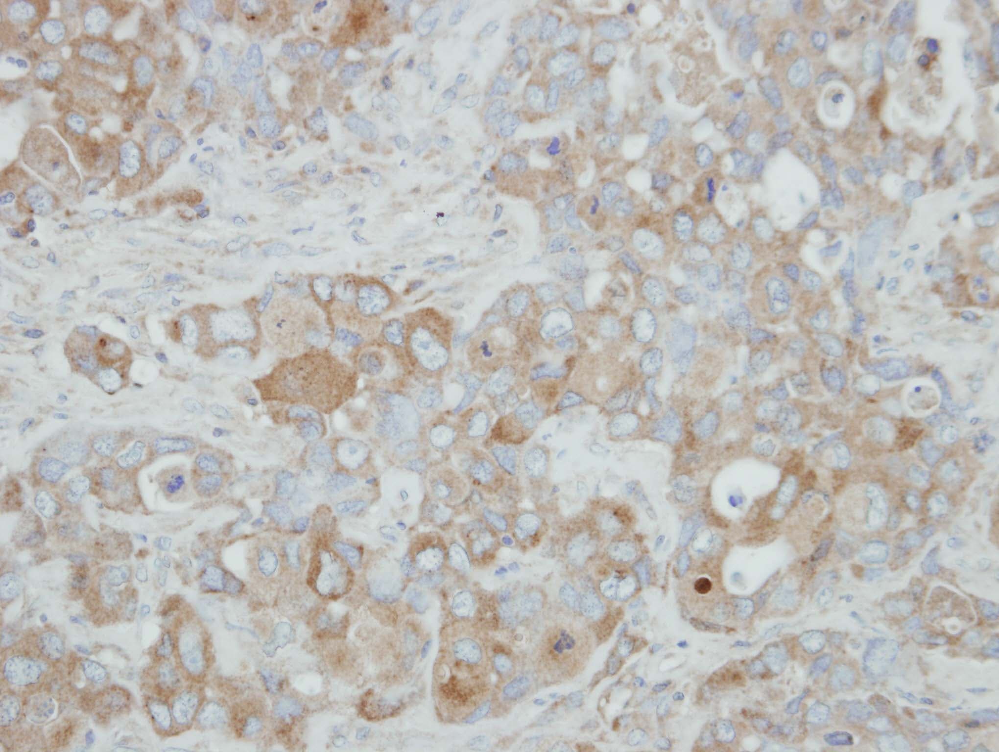 ACOX3 Antibody (aa408-603)