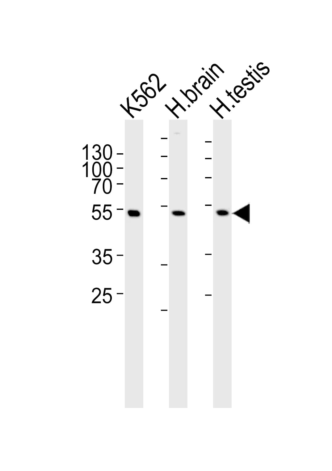 GABRG3 Antibody (aa1-29)