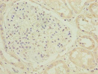 Polyclonal Rabbit anti-Human C17orf47 Antibody (IHC)