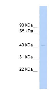 PRKAR1A Antibody (C-Terminus)