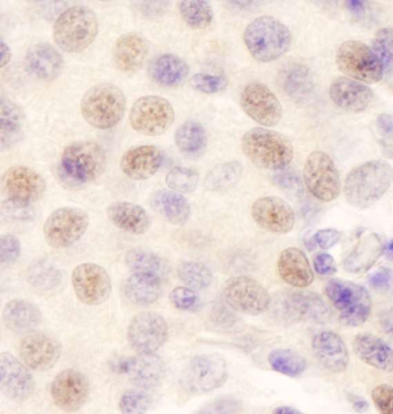 Polyclonal Rabbit anti-Human GATAD2B Antibody (aa543-593, IHC)