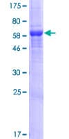 Human LDAH Protein (Recombinant GST)