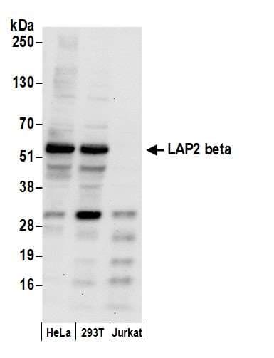 TMPO / TP / Thymopoietin Antibody (aa350-400)